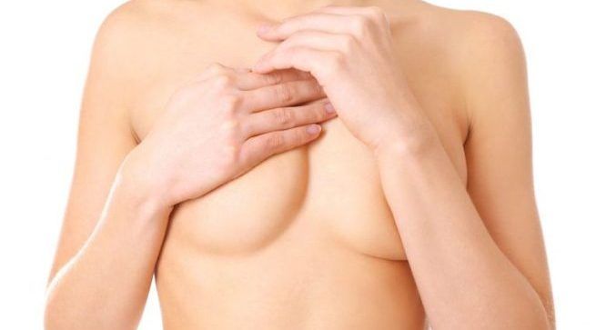 A malformação dos seios atinge um grande número de mulheres desde a puberdade e pode ser corrigida com a cirurgia plástica (Foto: Divulgação)