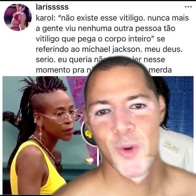 Vitor Maccla: "Quem tem vitiligo não quer mudar sua origem racial. O vitiligo não muda a identidade racial de ninguém" (Reprodução Instagram)